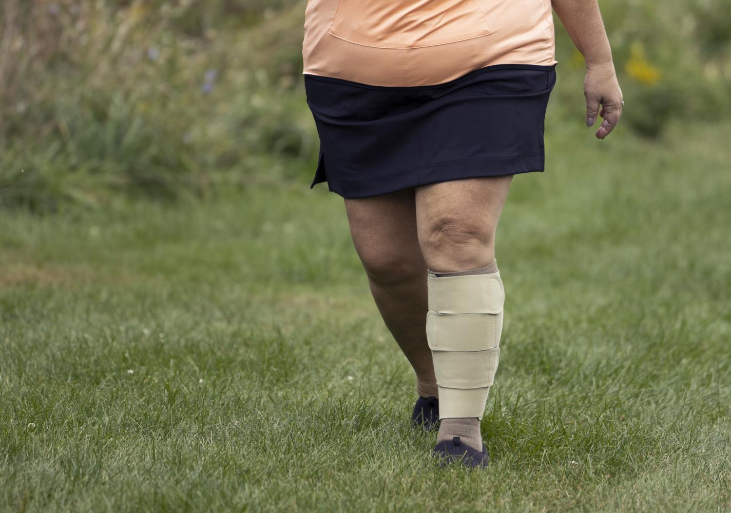 A woman wearing a leg wrap